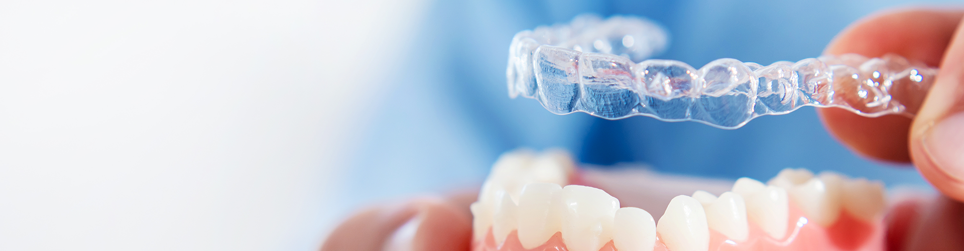 mouth model with clear aligner